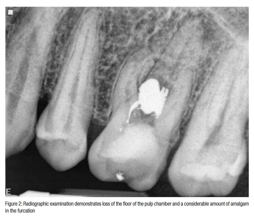 figure2