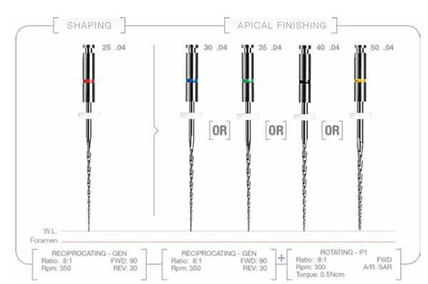 Figure 2: Genius Sequence: After pre-flaring, use the Genius 25 .04 in reciprocation until the working length. Choose one of the final enlargement options based on the anatomy of the canal. The final file will be used in reciprocation until the working length and, after that, rotation movement will be used to remove debris