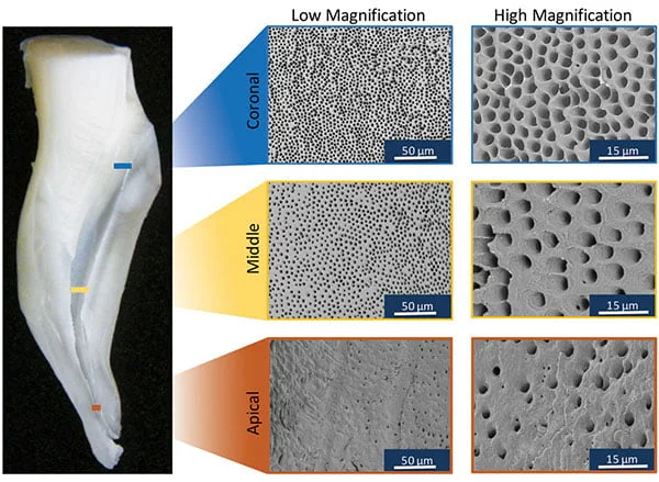 Low and high magnification images at different regions from a root of a curved molar, after cleaned with the GentleWave System