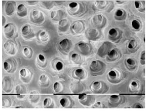 Figure 3: SEM showing complete removal of bacteria and pulpal tissue in the apical one-third after irrigation using the LT-IPI™ protocol (Courtesy Prof. Georgi Tomov, Plovdiv, Bulgaria)