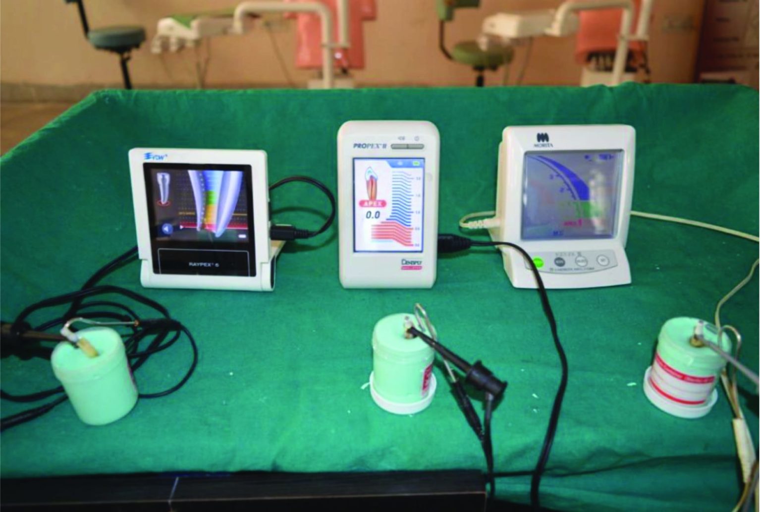 Accuracy comparison of three different electronic apex locators in