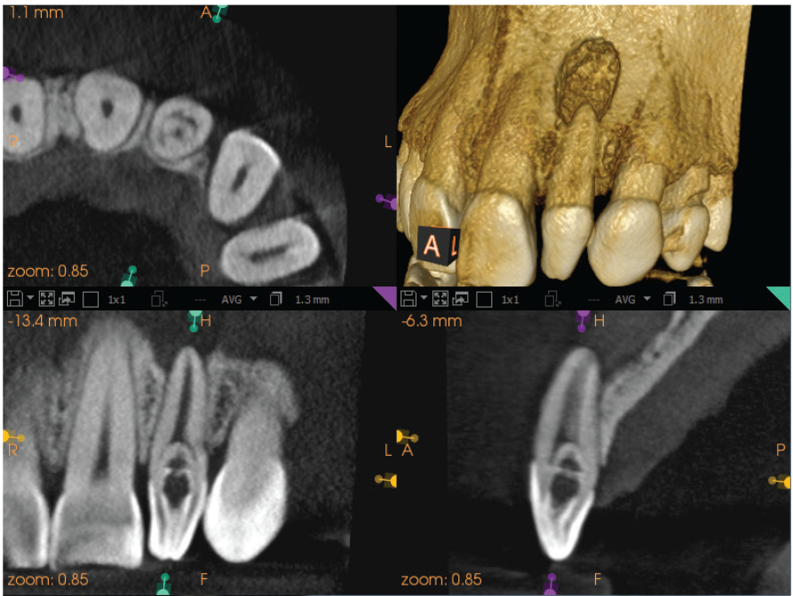 kodak dental imaging software carestream