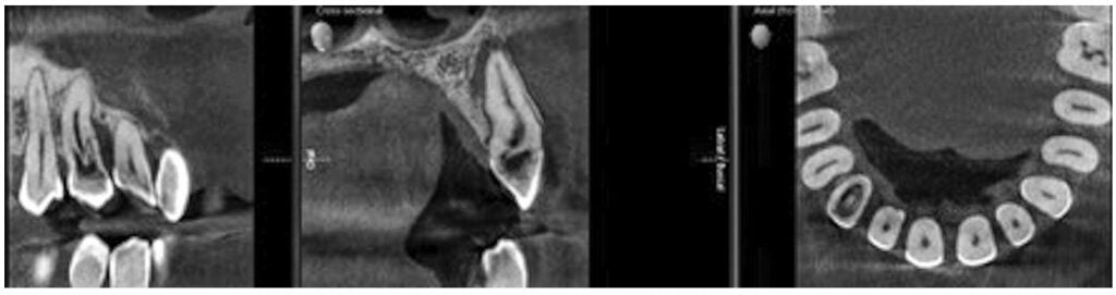 Orthophos SL CBCT — for improved diagnostics