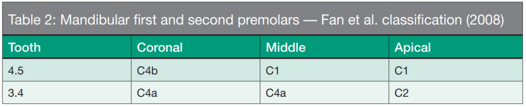 Table 2: Mandibular first and second premolars — Fan et al. classification (2008)