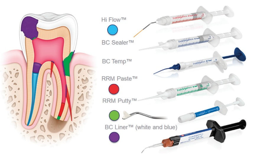 Brasseler, GentleWave and US Endo Partners — innovators in endodontics