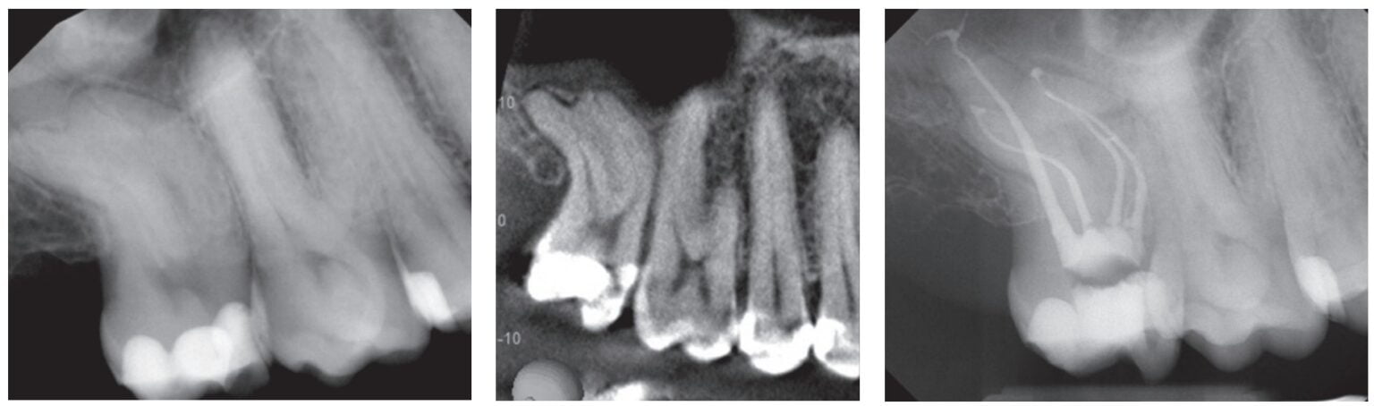 Pulp Radiograph Technology advancements — differentiate yourself!